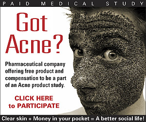 Acne Study