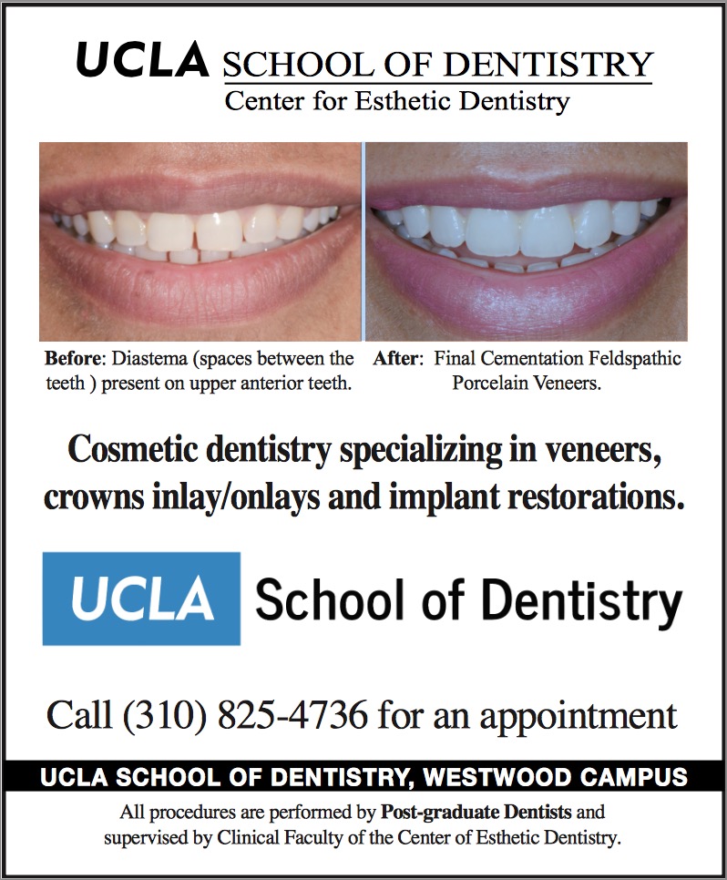 UCLA School of Dentistry: Center for Esthetic Dentistry